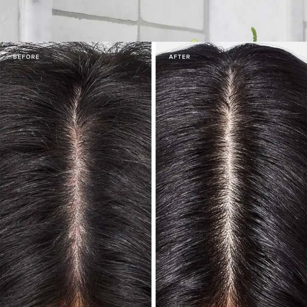 Clean Beauty Scalp Therapy Shampoo - Image 3